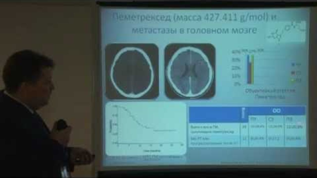 Химиотерапия при метастазах рака легкого