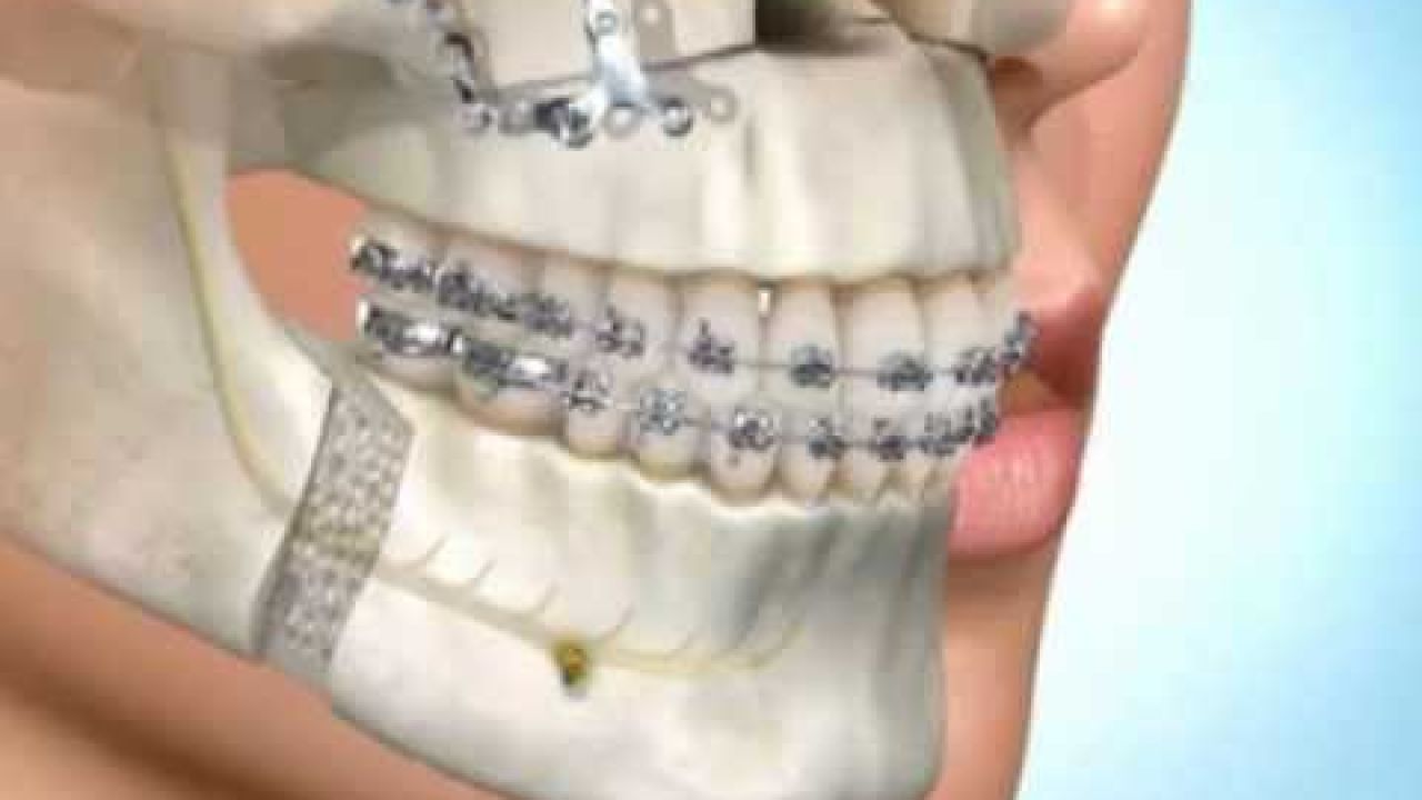 Зубы - Возможности эстетической стоматологии